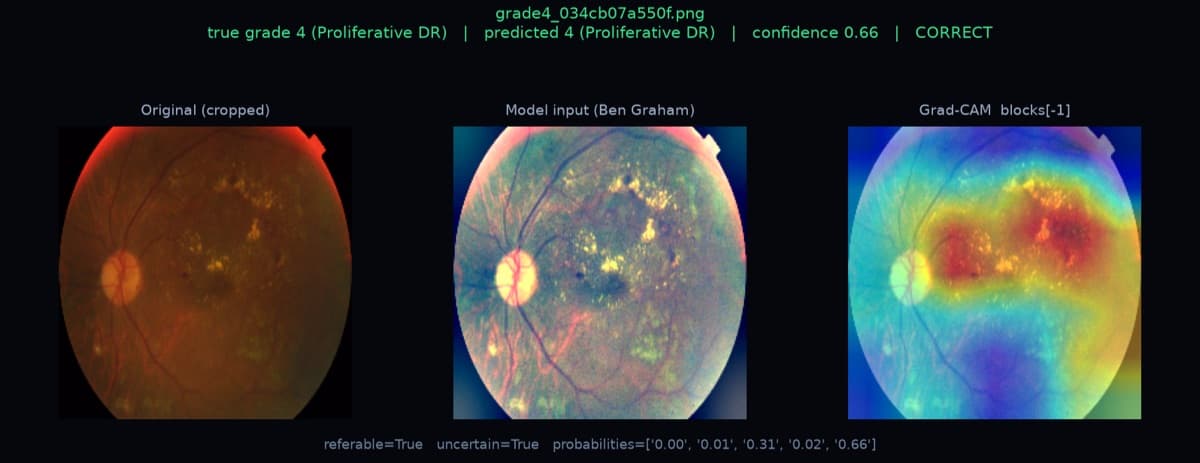 Grad-CAM evaluation panel: original scan, model input, and heatmap